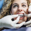 Orthodontics Shapes Modern Lifestyles